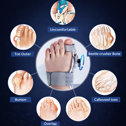 AlignFlex™-Bunion Corrector